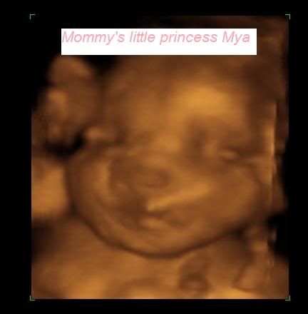 3d ultrasound pictures of twins. I#39;m due with twins October