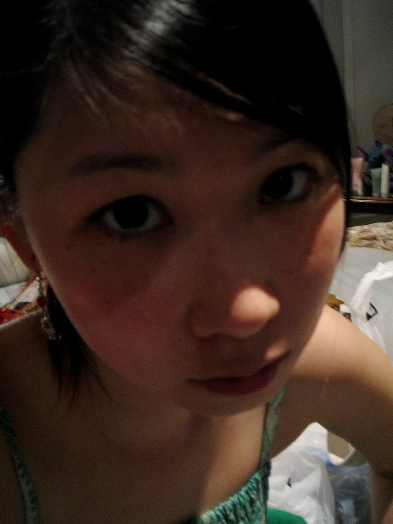 Black Eye